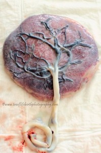 Placenta tree of life, treoflifebirthphotography.com